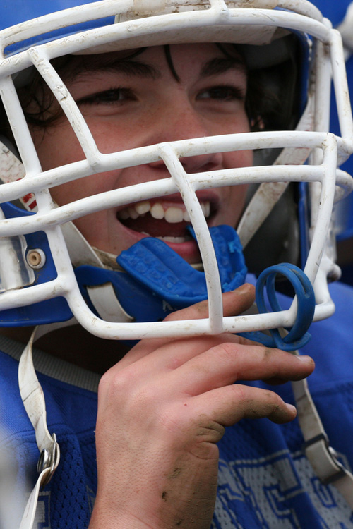 Mouth Guard For Teeth Grinding | Carolina Oaks Dental Care Of Greenville SC